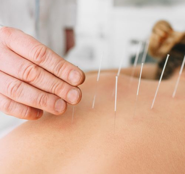 acupuncture cbd